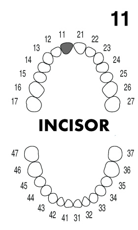 INCISOR 1.1