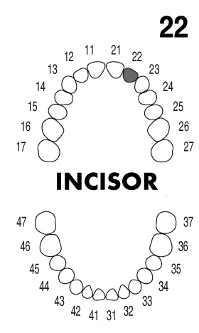 INCISOR 2.2