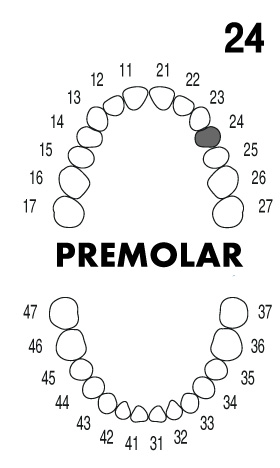 PREMOLAR 2.4