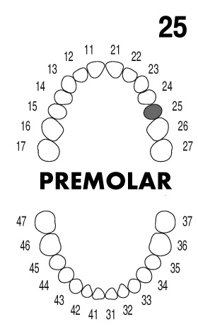 PREMOLAR 2.5