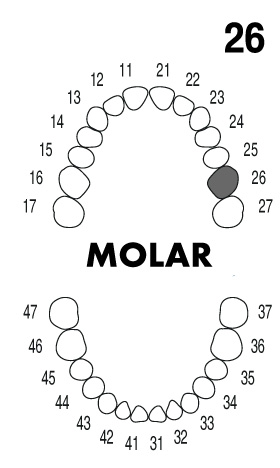MOLAR 2.6