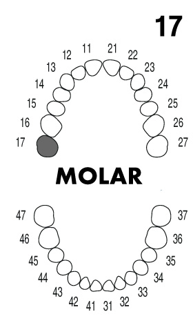 MOLAR 1.7