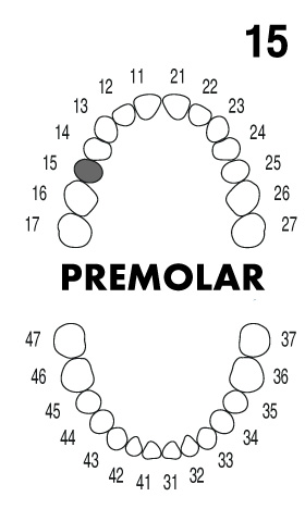 PREMOLAR 1.5