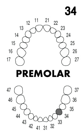 PREMOLAR 3.4
