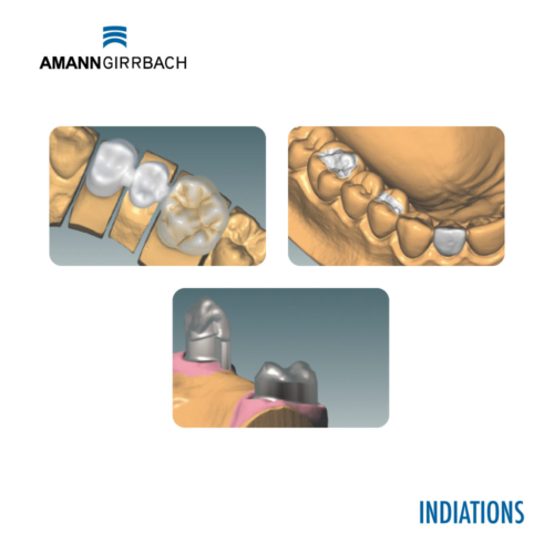 Banner-Ceramill-Mind-CAD-Software-Base-Version2